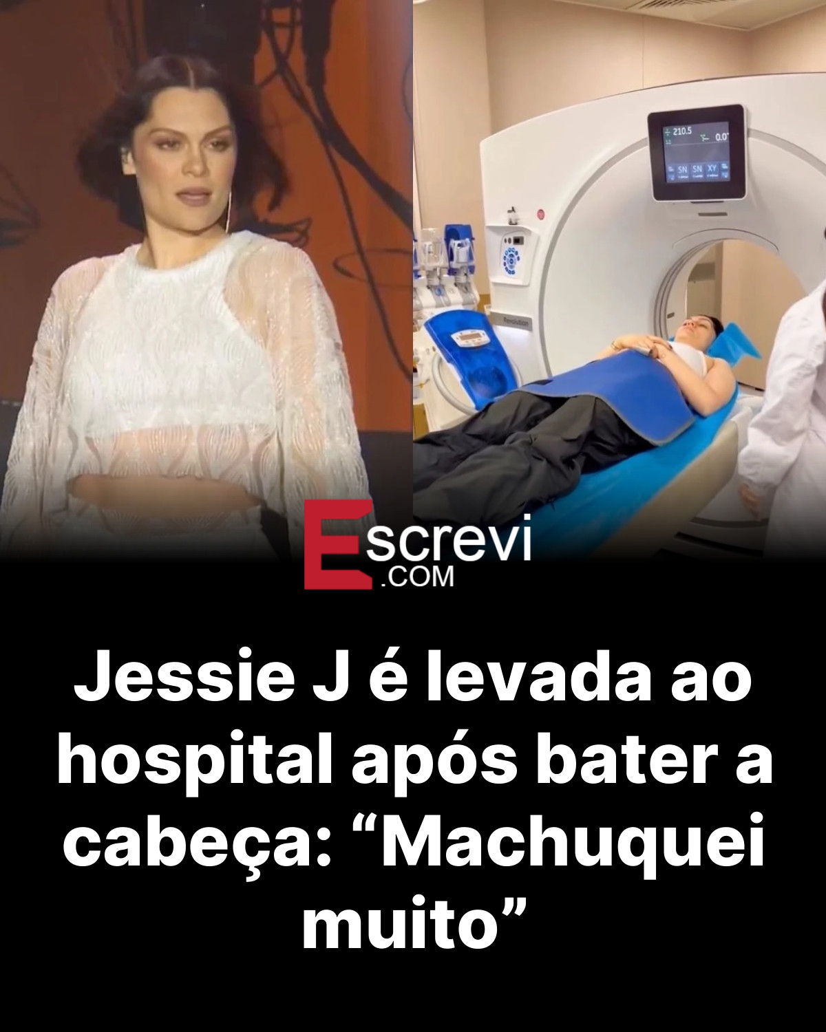 Jessie J é levada ao hospital após bater a cabeça: “Machuquei muito” card preto
