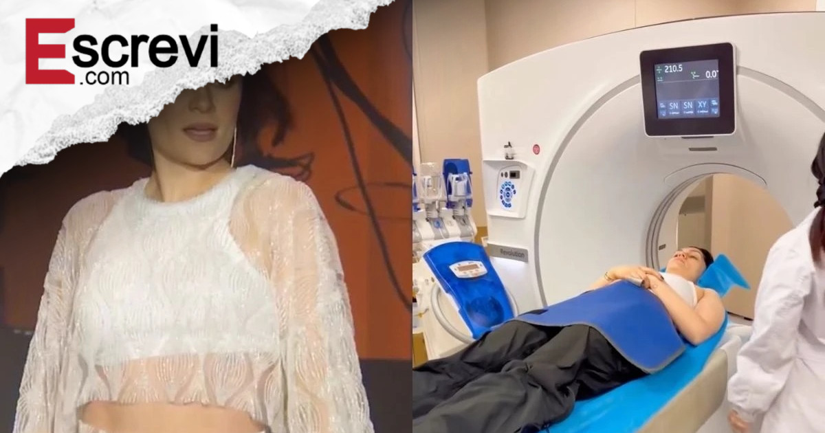 Jessie J é levada ao hospital após bater a cabeça: “Machuquei muito” imagem principal