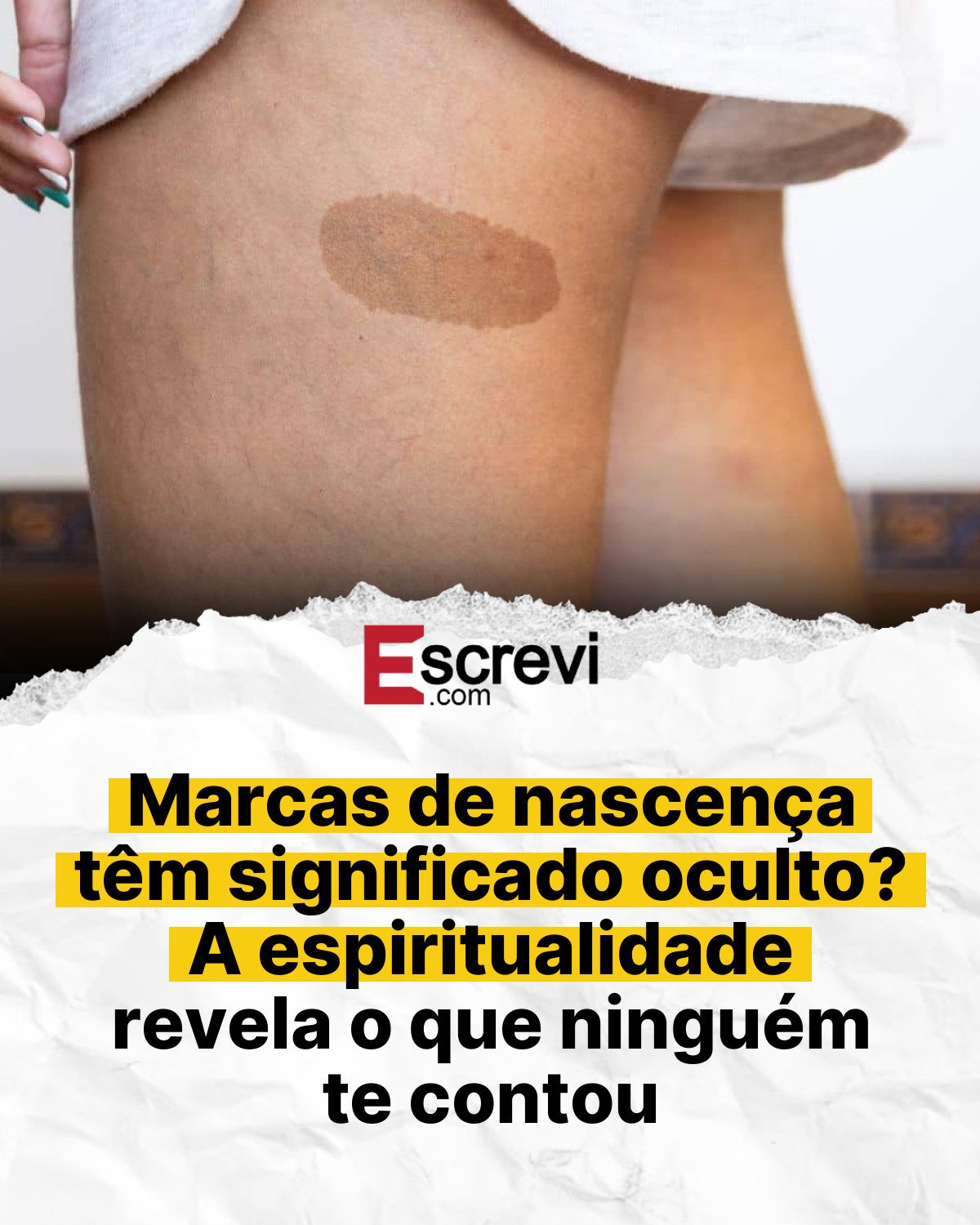Marcas de nascença têm significado oculto? A espiritualidade revela o que ninguém te contou card branco
