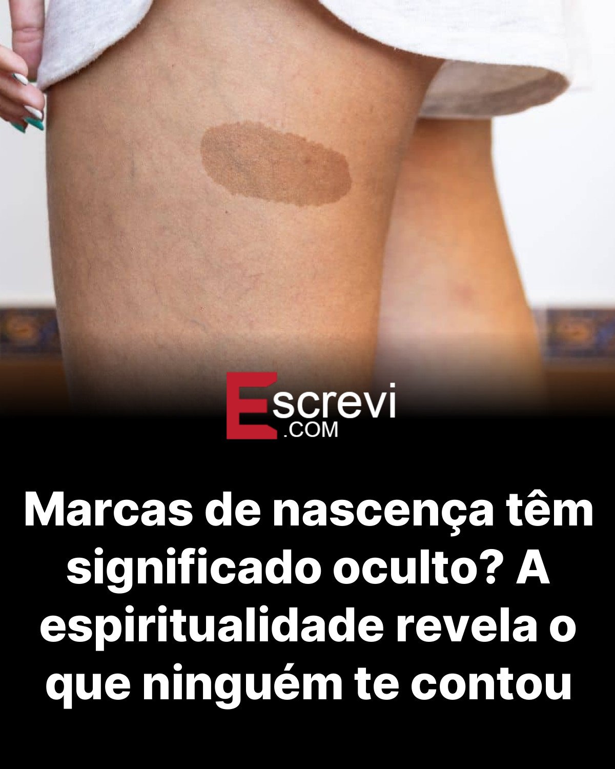 Marcas de nascença têm significado oculto? A espiritualidade revela o que ninguém te contou card preto