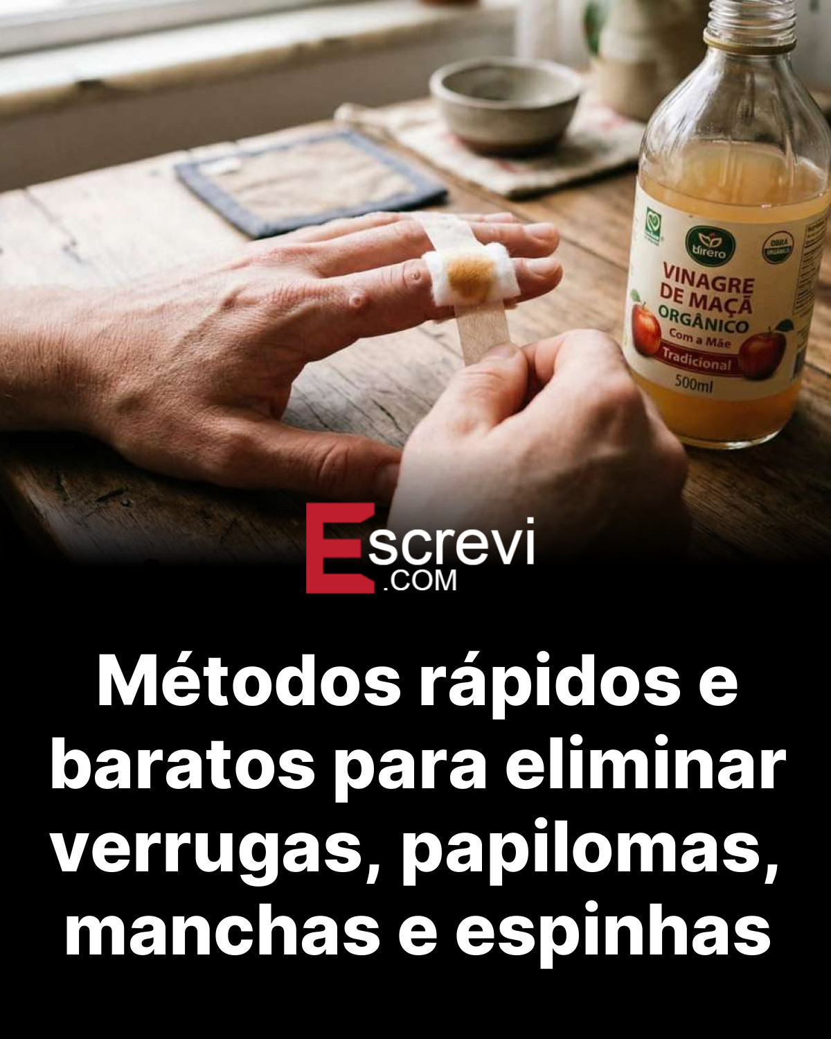 Métodos rápidos e baratos para eliminar verrugas, papilomas, manchas e espinhas card preto