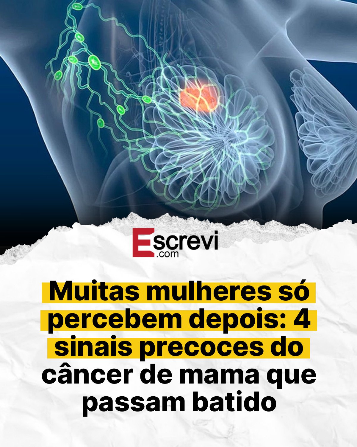 Muitas mulheres só percebem depois: 4 sinais precoces do câncer de mama que passam batido card branco