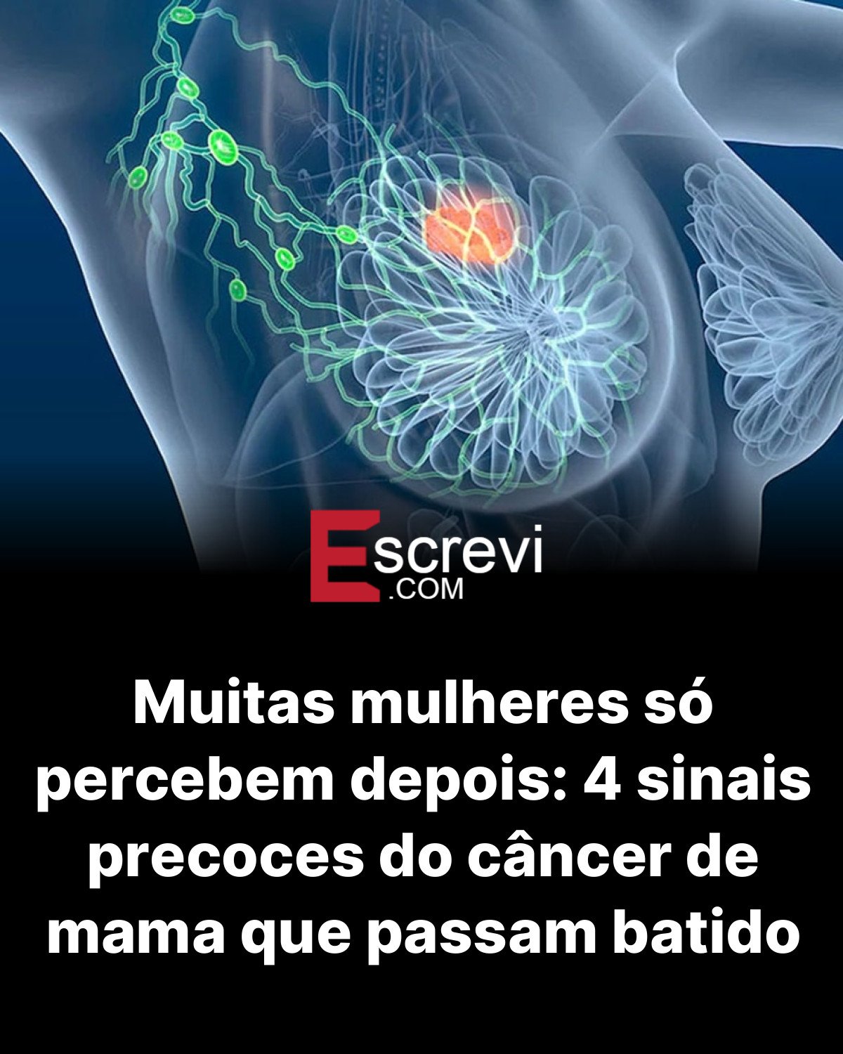 Muitas mulheres só percebem depois: 4 sinais precoces do câncer de mama que passam batido card preto