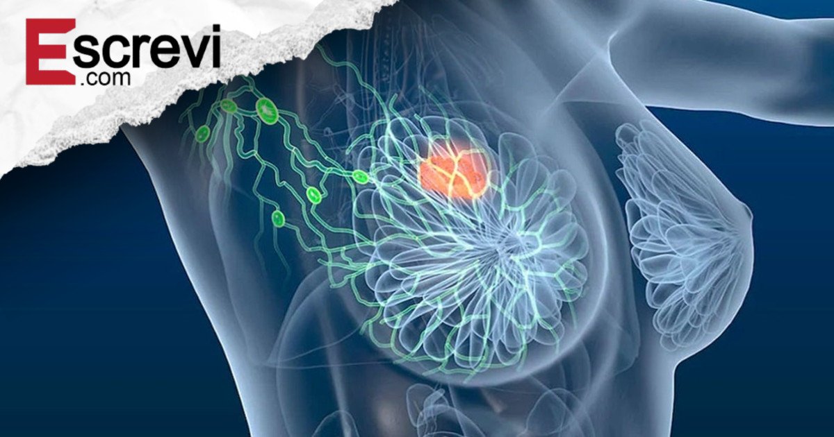 Muitas mulheres só percebem depois: 4 sinais precoces do câncer de mama que passam batido imagem principal