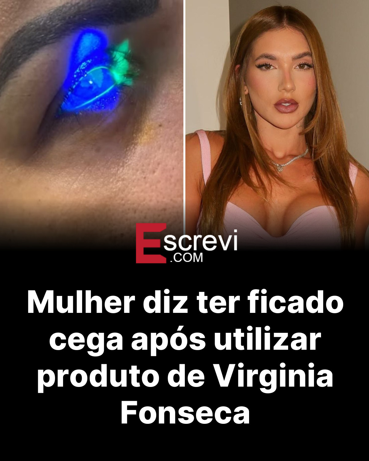 Mulher diz ter ficado cega após utilizar produto de Virginia Fonseca card preto