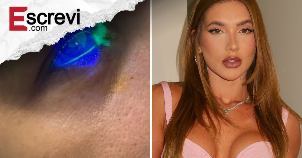 Mulher diz ter ficado cega após utilizar produto de Virginia Fonseca imagem principal