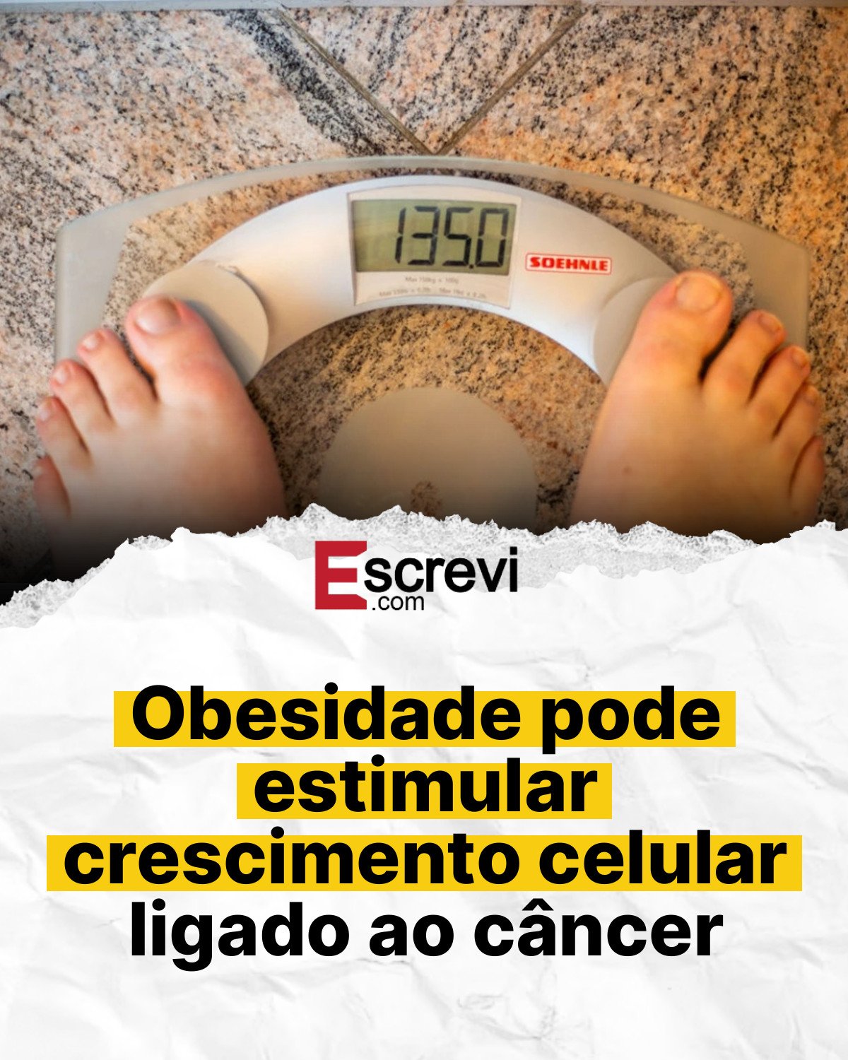 Obesidade pode estimular crescimento celular ligado ao câncer card branco