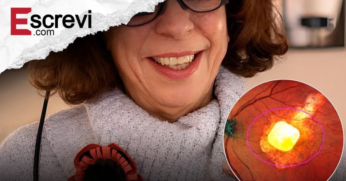 Olho biônico PRIMA devolve leitura e autonomia a pacientes com degeneração macular avançada imagem principal