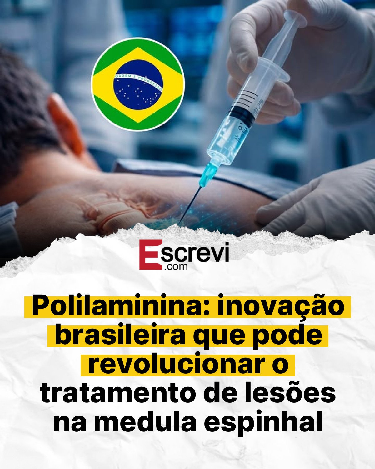 Polilaminina: inovação brasileira que pode revolucionar o tratamento de lesões na medula espinhal card branco