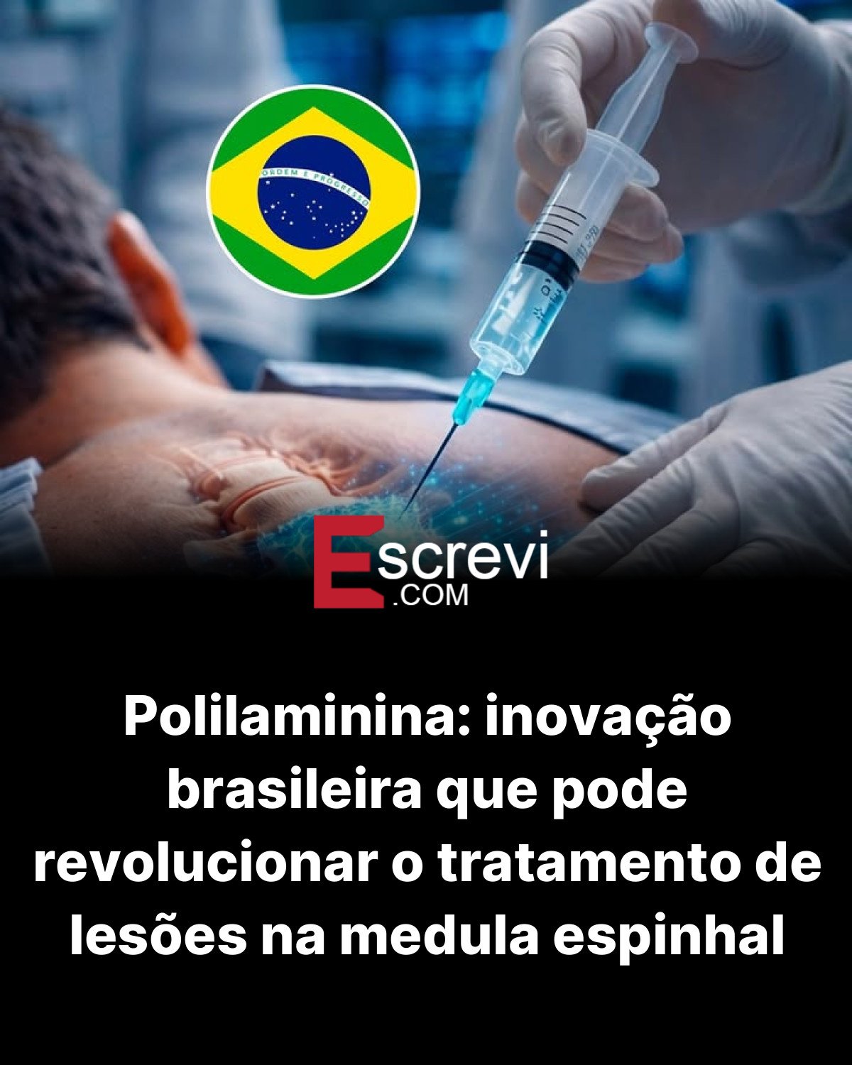 Polilaminina: inovação brasileira que pode revolucionar o tratamento de lesões na medula espinhal card preto