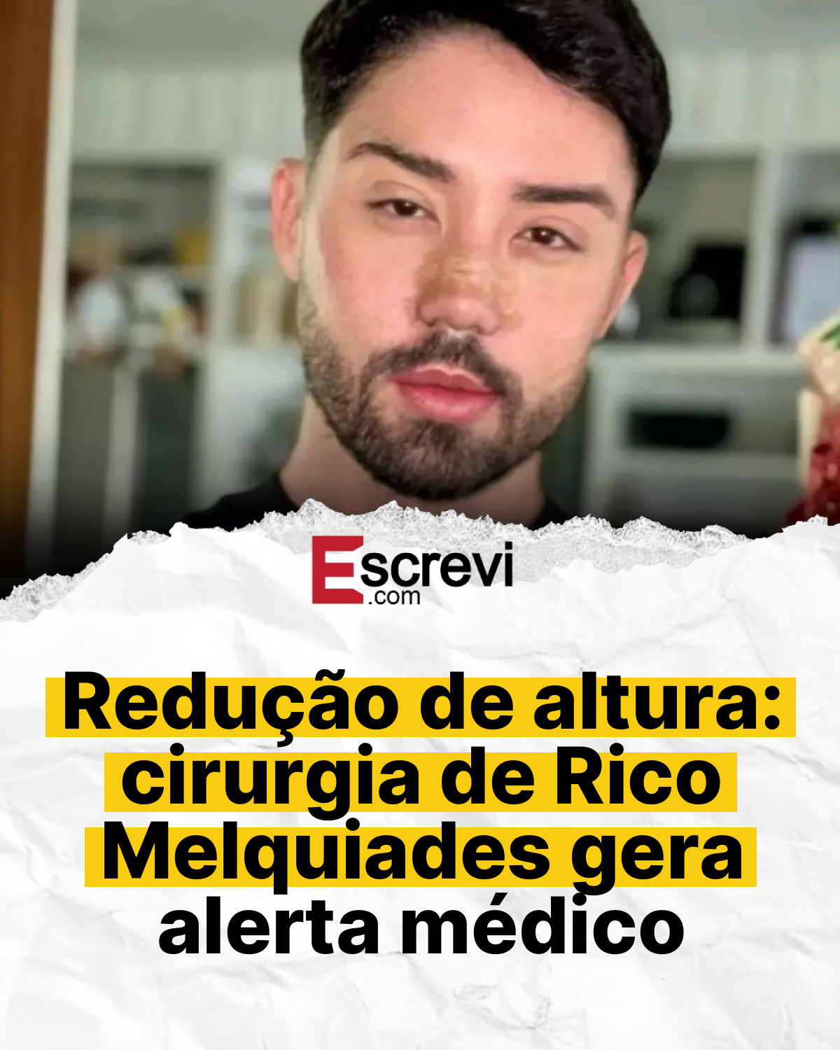 Redução de altura: cirurgia de Rico Melquiades gera alerta médico card branco