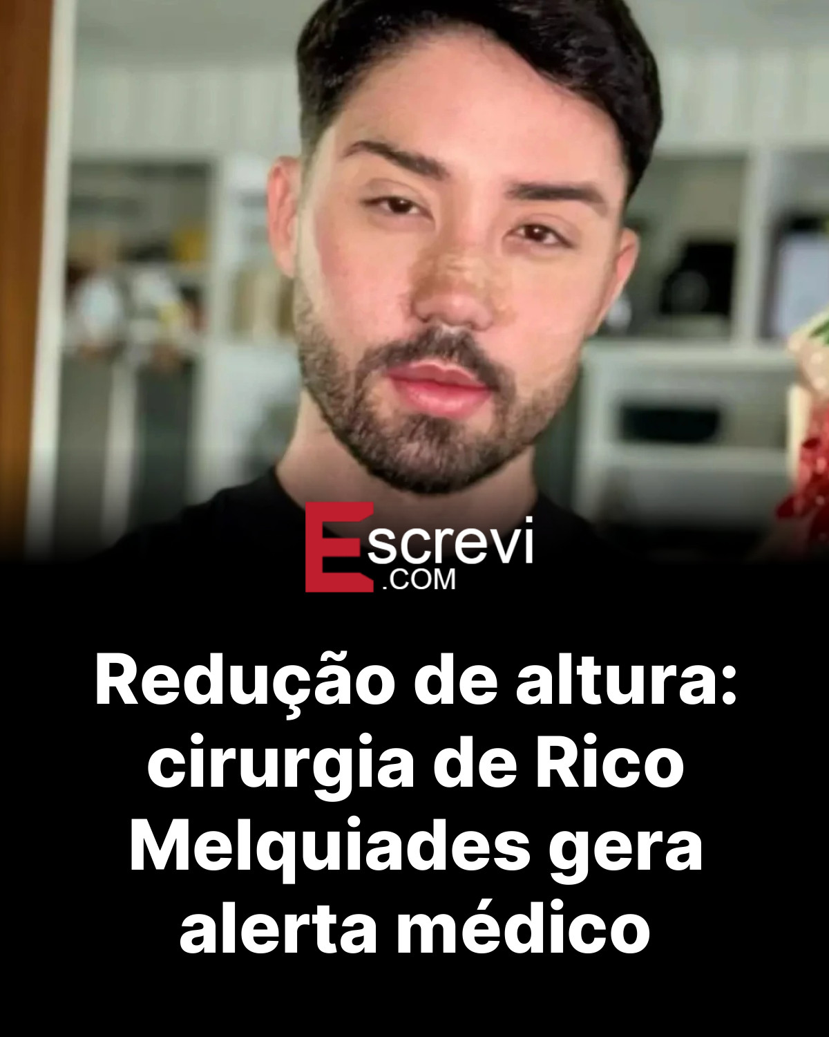 Redução de altura: cirurgia de Rico Melquiades gera alerta médico card preto