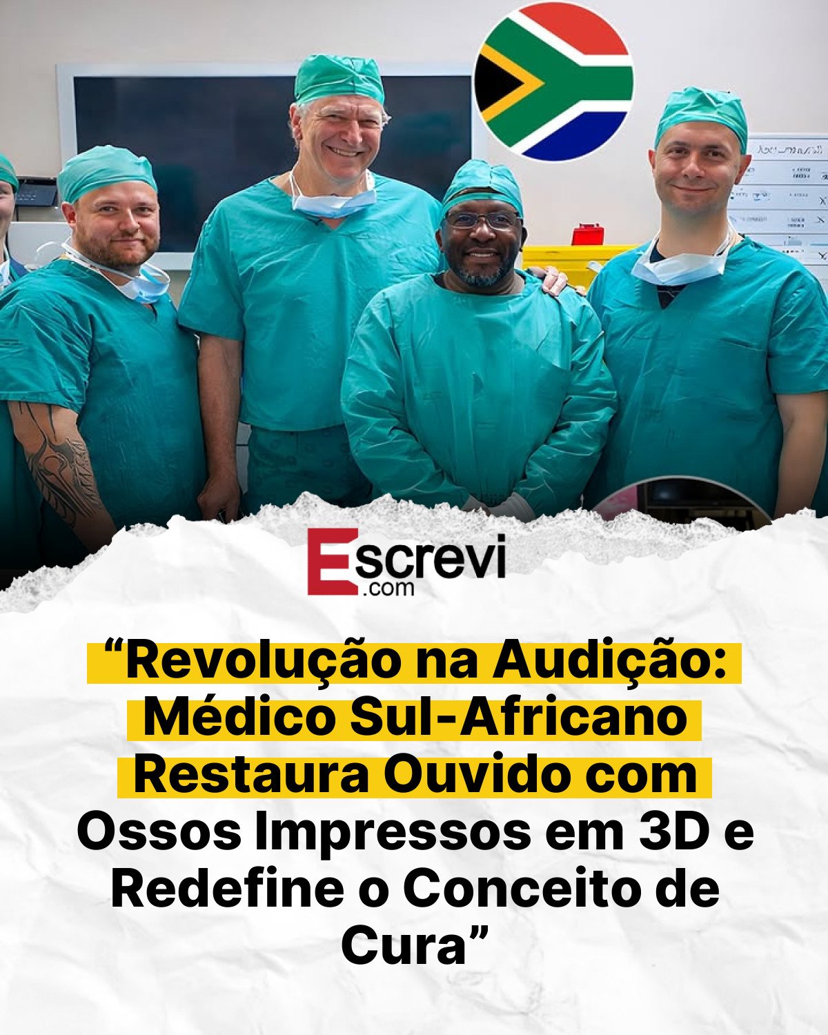 “Revolução na Audição: Médico Sul-Africano Restaura Ouvido com Ossos Impressos em 3D e Redefine o Conceito de Cura” card branco