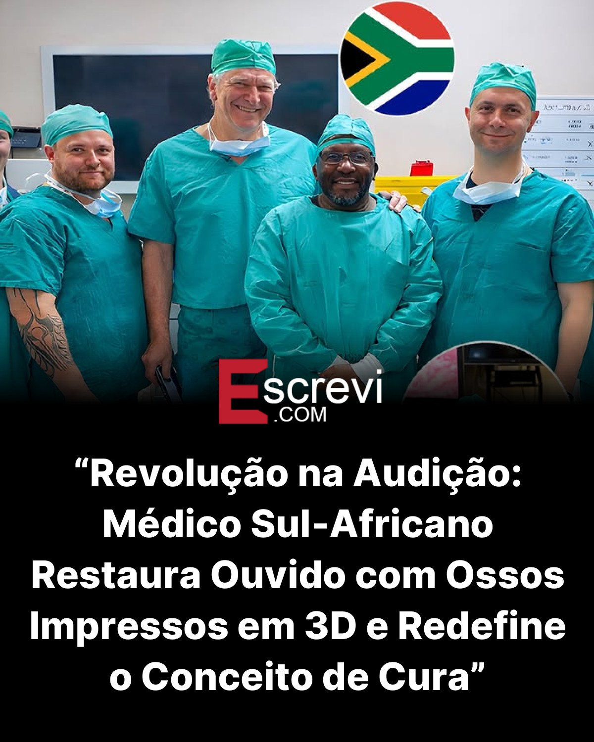 “Revolução na Audição: Médico Sul-Africano Restaura Ouvido com Ossos Impressos em 3D e Redefine o Conceito de Cura” card preto