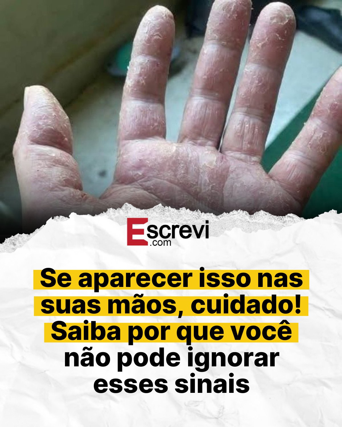 Se aparecer isso nas suas mãos, cuidado! Saiba por que você não pode ignorar esses sinais card branco