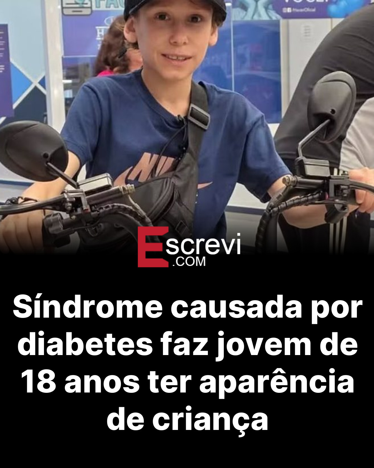 Síndrome causada por diabetes faz jovem de 18 anos ter aparência de criança card preto