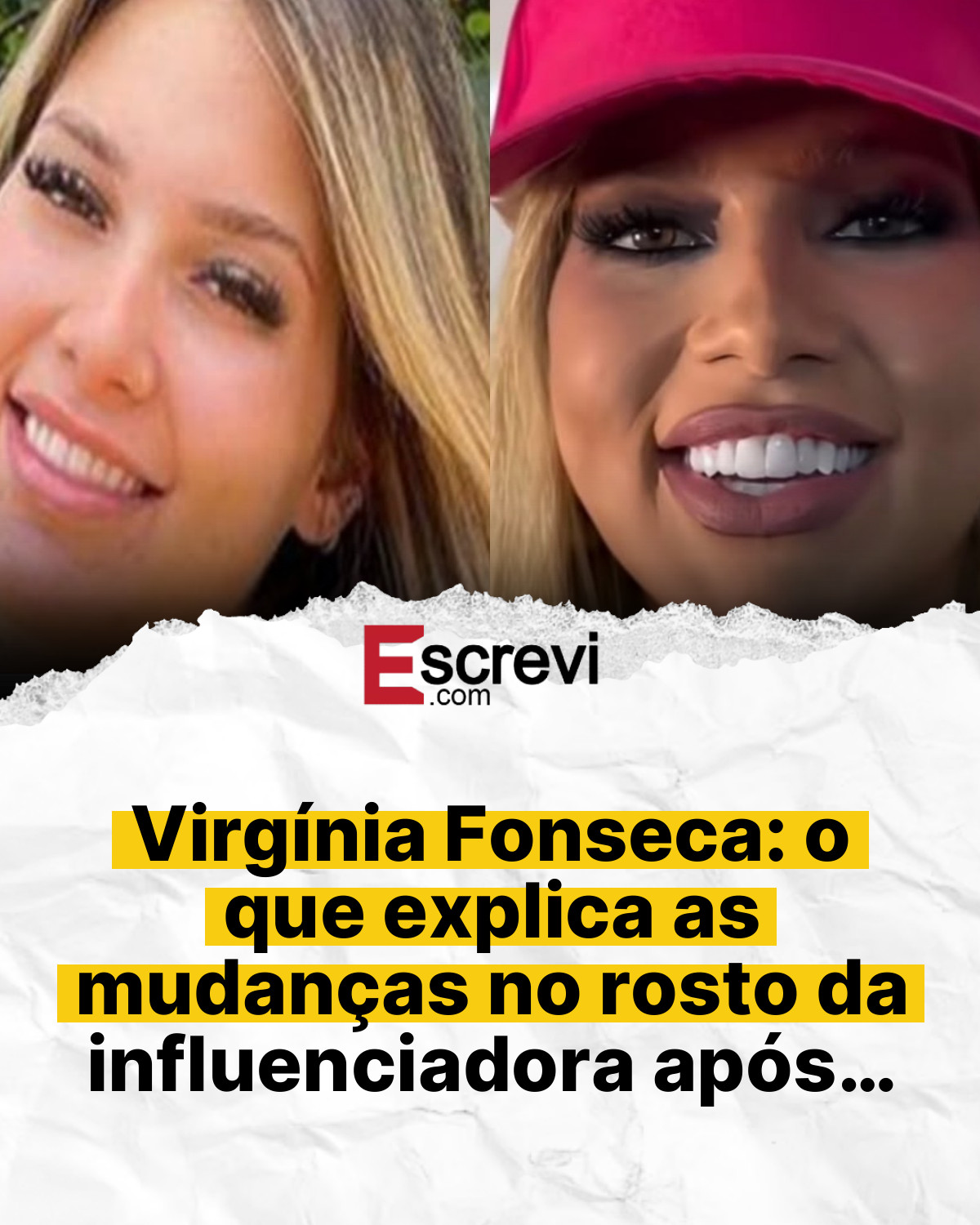 Virgínia Fonseca: o que explica as mudanças no rosto da influenciadora após… card branco