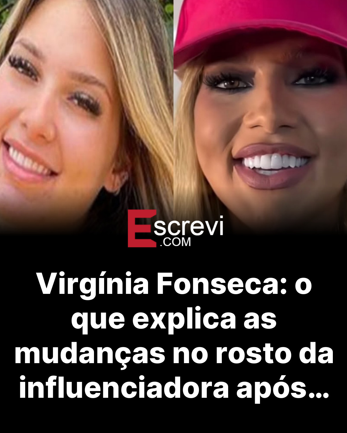 Virgínia Fonseca: o que explica as mudanças no rosto da influenciadora após… card preto