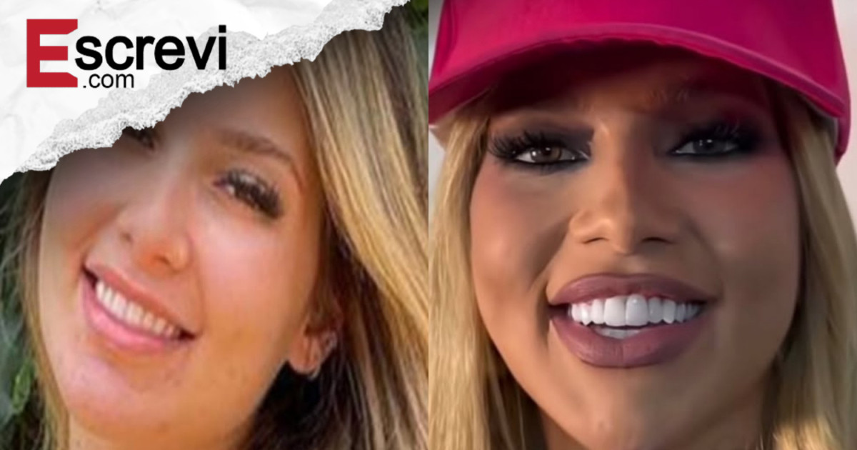 Virgínia Fonseca: o que explica as mudanças no rosto da influenciadora após… imagem principal