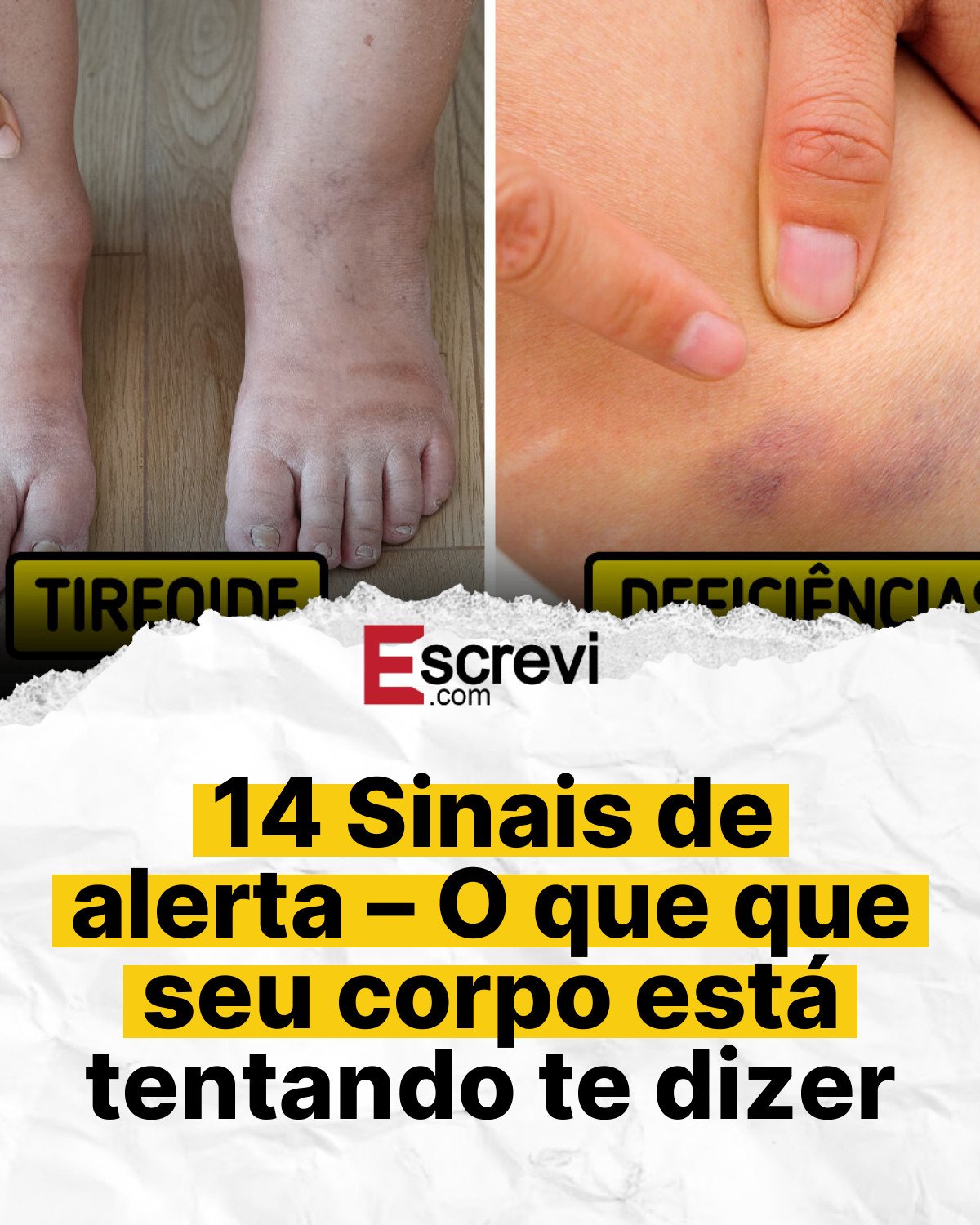 14 Sinais de alerta – O que que seu corpo está tentando te dizer card branco