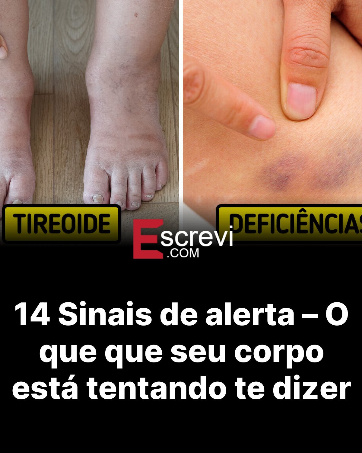 14 Sinais de alerta – O que que seu corpo está tentando te dizer card preto