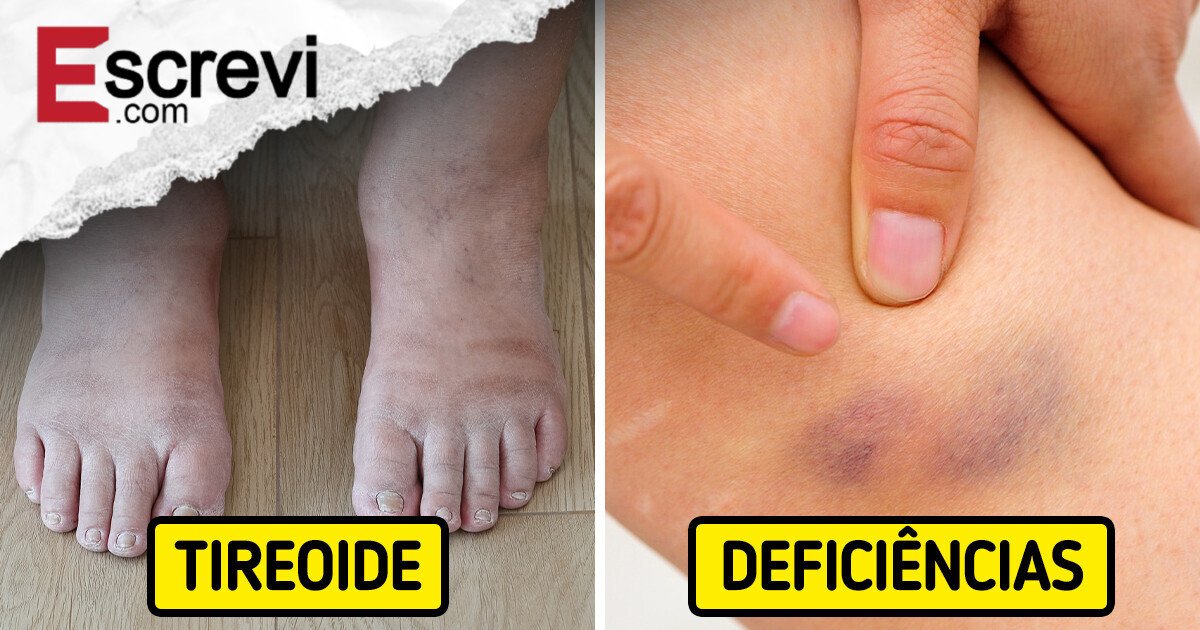 14 Sinais de alerta – O que que seu corpo está tentando te dizer imagem principal