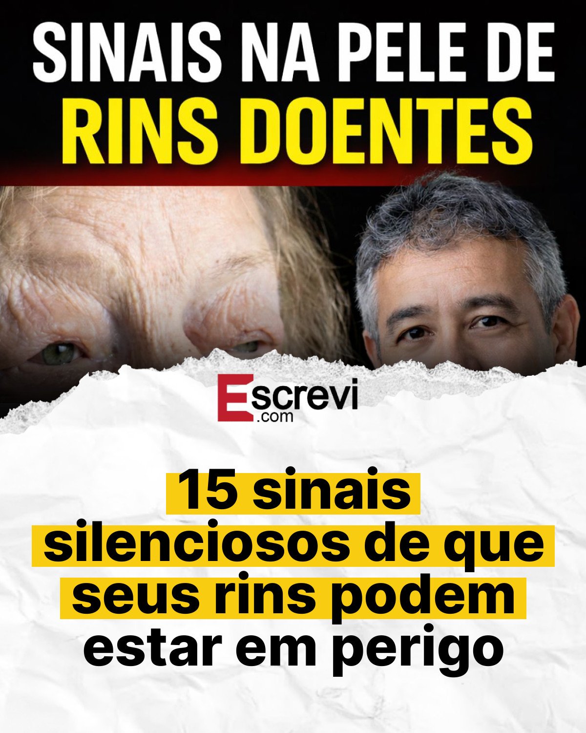 15 sinais silenciosos de que seus rins podem estar em perigo card branco