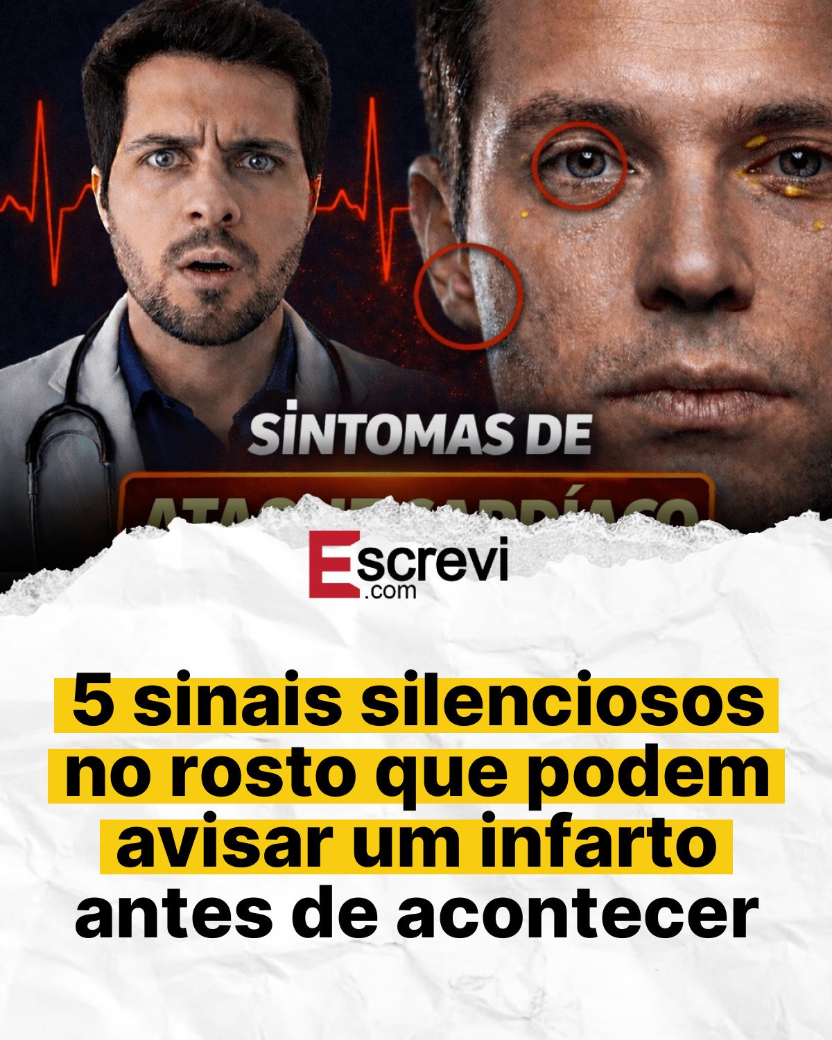 5 sinais silenciosos no rosto que podem avisar um infarto antes de acontecer card branco