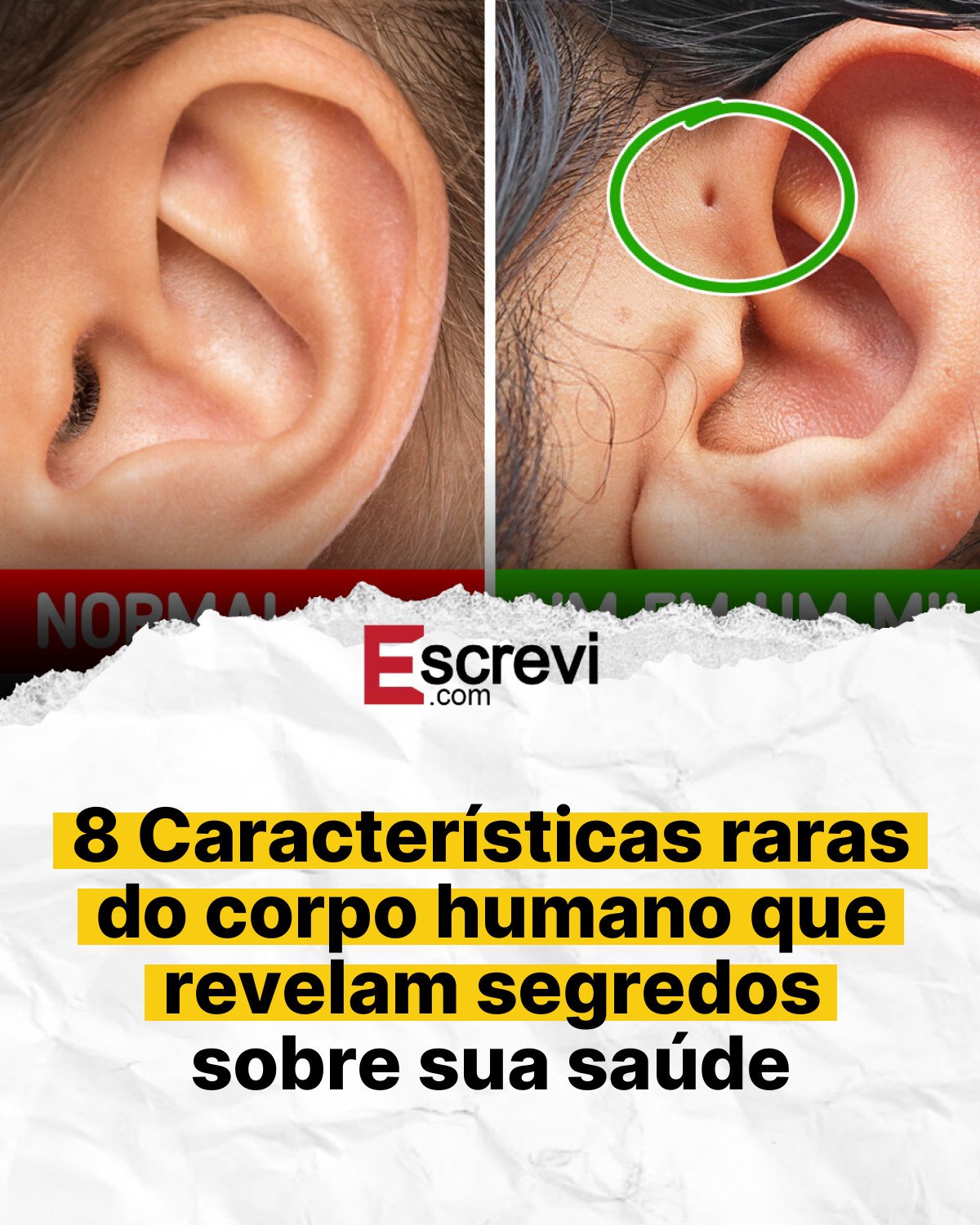 8 Características raras do corpo humano que revelam segredos sobre sua saúde card branco