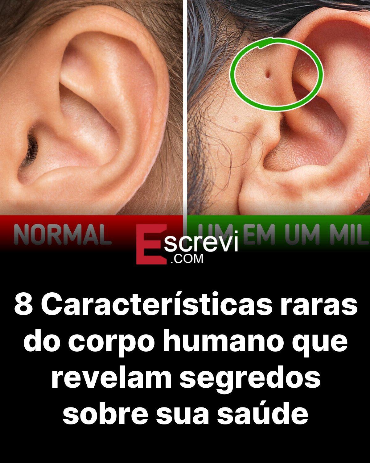8 Características raras do corpo humano que revelam segredos sobre sua saúde card preto