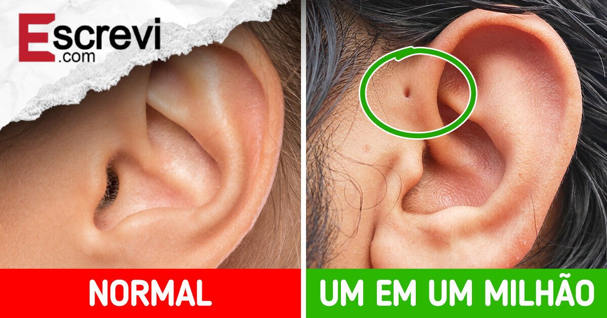 8 Características raras do corpo humano que revelam segredos sobre sua saúde imagem principal