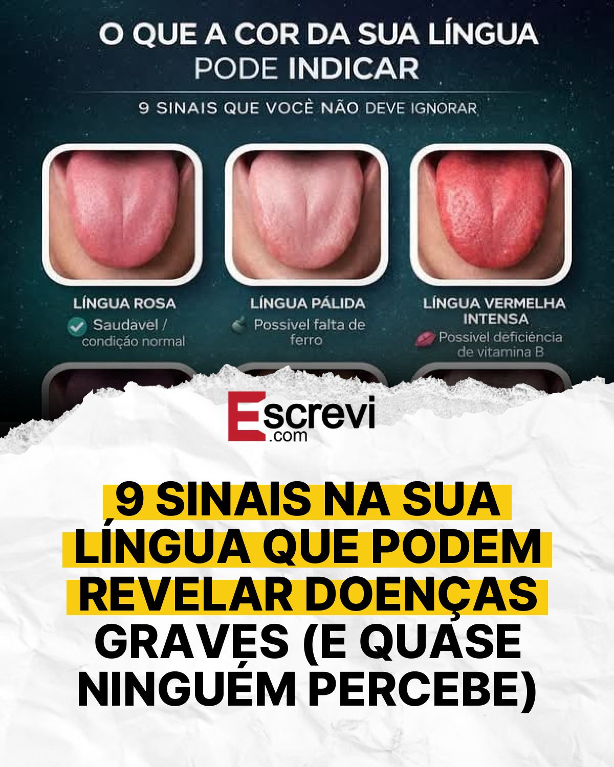 9 SINAIS NA SUA LÍNGUA QUE PODEM REVELAR DOENÇAS GRAVES (E QUASE NINGUÉM PERCEBE) card branco