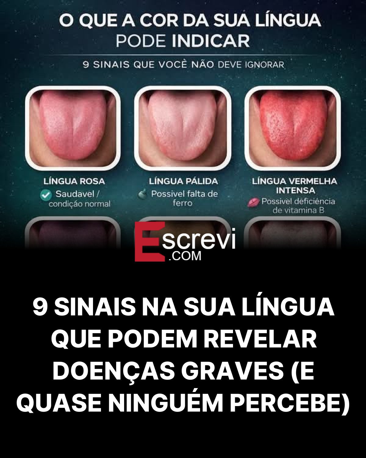 9 SINAIS NA SUA LÍNGUA QUE PODEM REVELAR DOENÇAS GRAVES (E QUASE NINGUÉM PERCEBE) card preto
