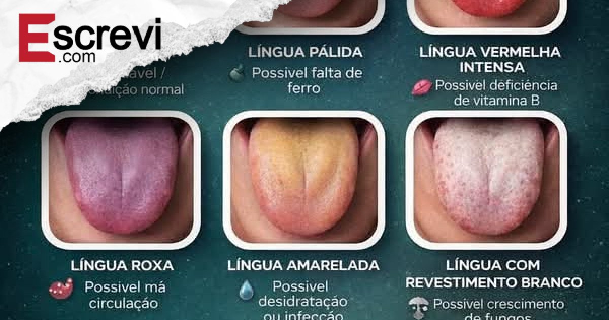 9 SINAIS NA SUA LÍNGUA QUE PODEM REVELAR DOENÇAS GRAVES (E QUASE NINGUÉM PERCEBE) imagem principal