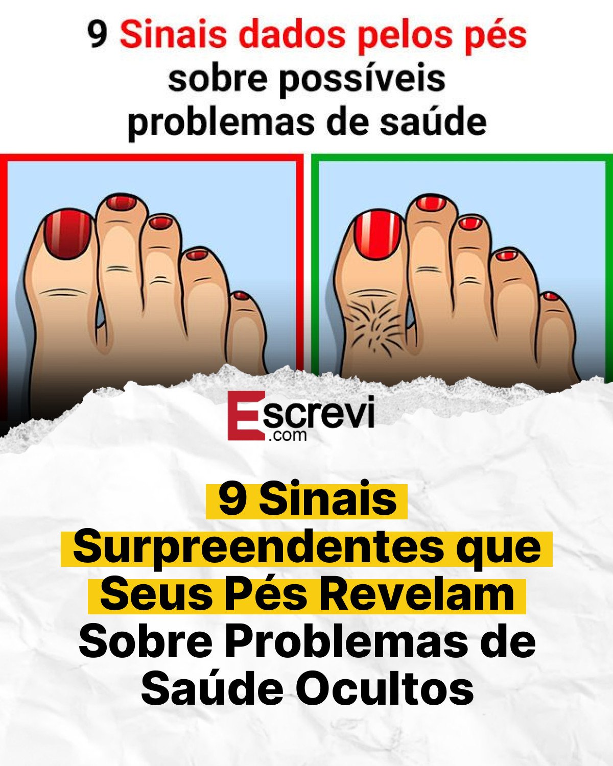 9 Sinais Surpreendentes que Seus Pés Revelam Sobre Problemas de Saúde Ocultos card branco
