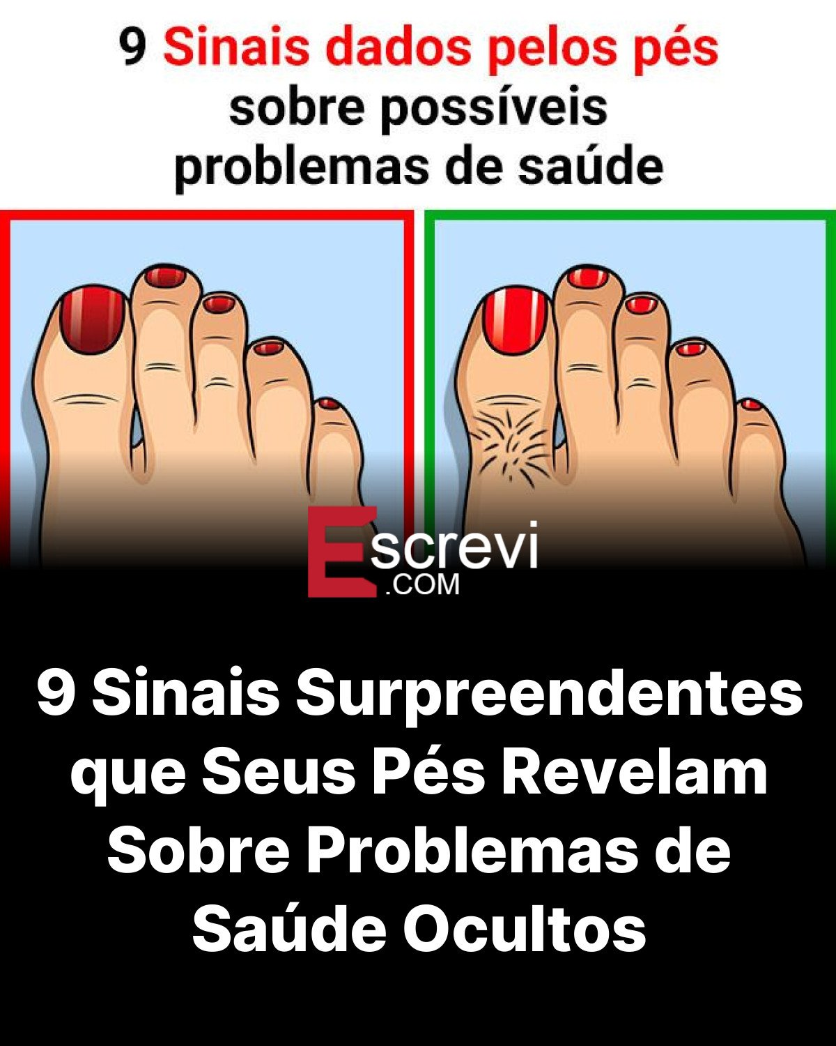 9 Sinais Surpreendentes que Seus Pés Revelam Sobre Problemas de Saúde Ocultos card preto