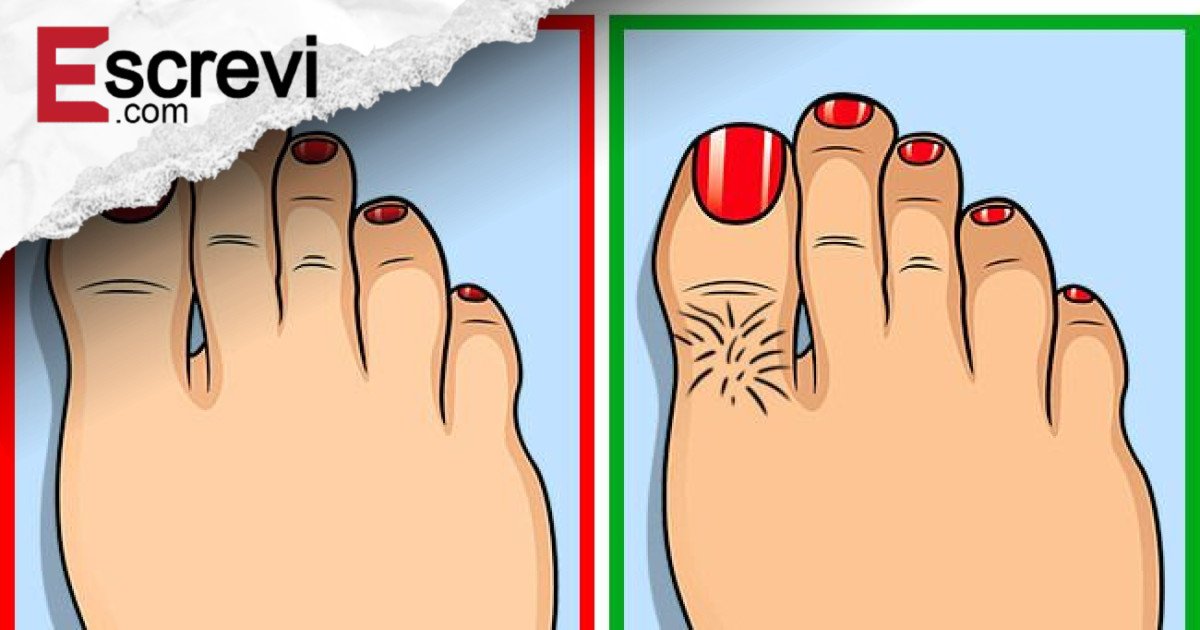 9 Sinais Surpreendentes que Seus Pés Revelam Sobre Problemas de Saúde Ocultos imagem principal