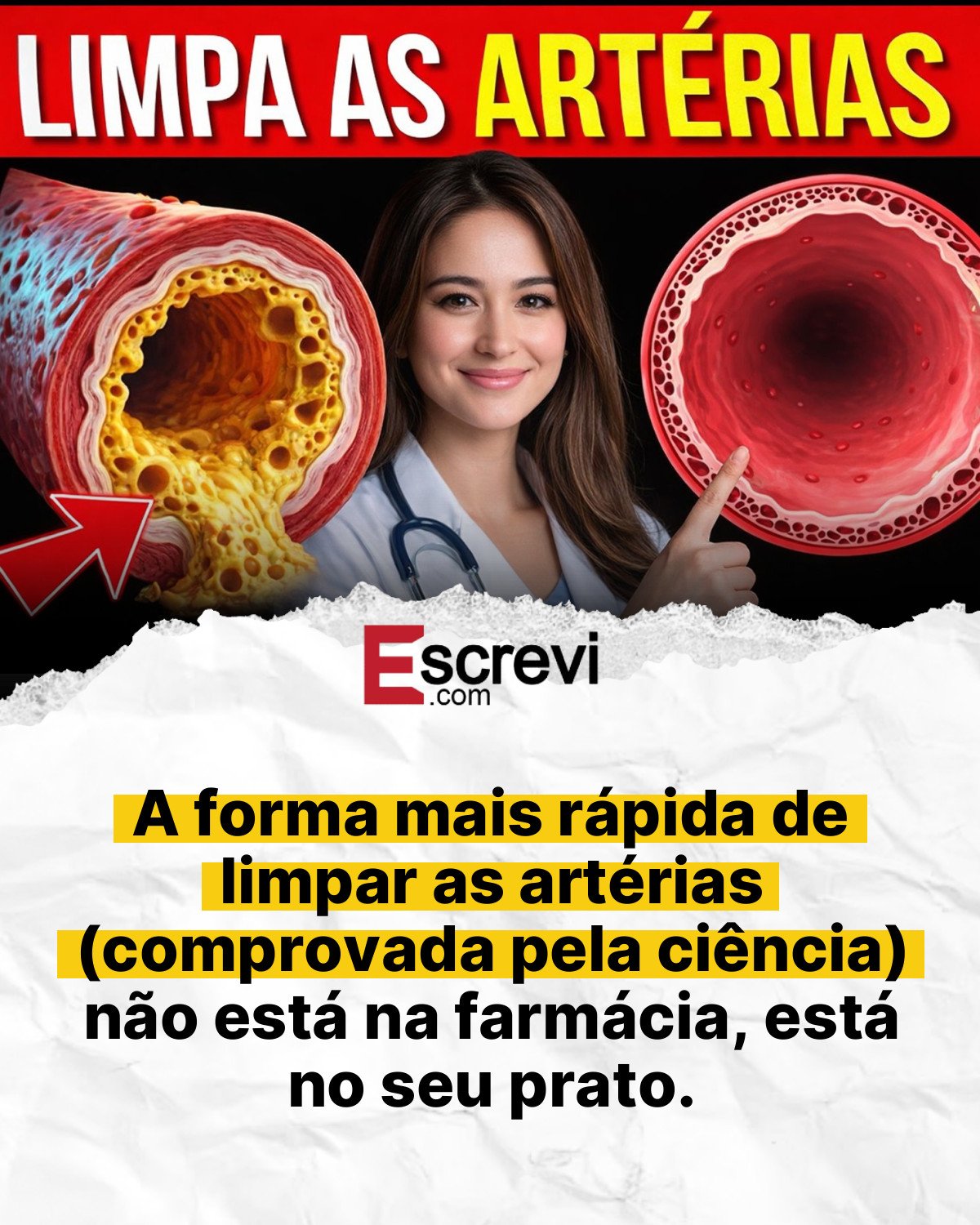 A forma mais rápida de limpar as artérias (comprovada pela ciência) não está na farmácia, está no seu prato. card branco