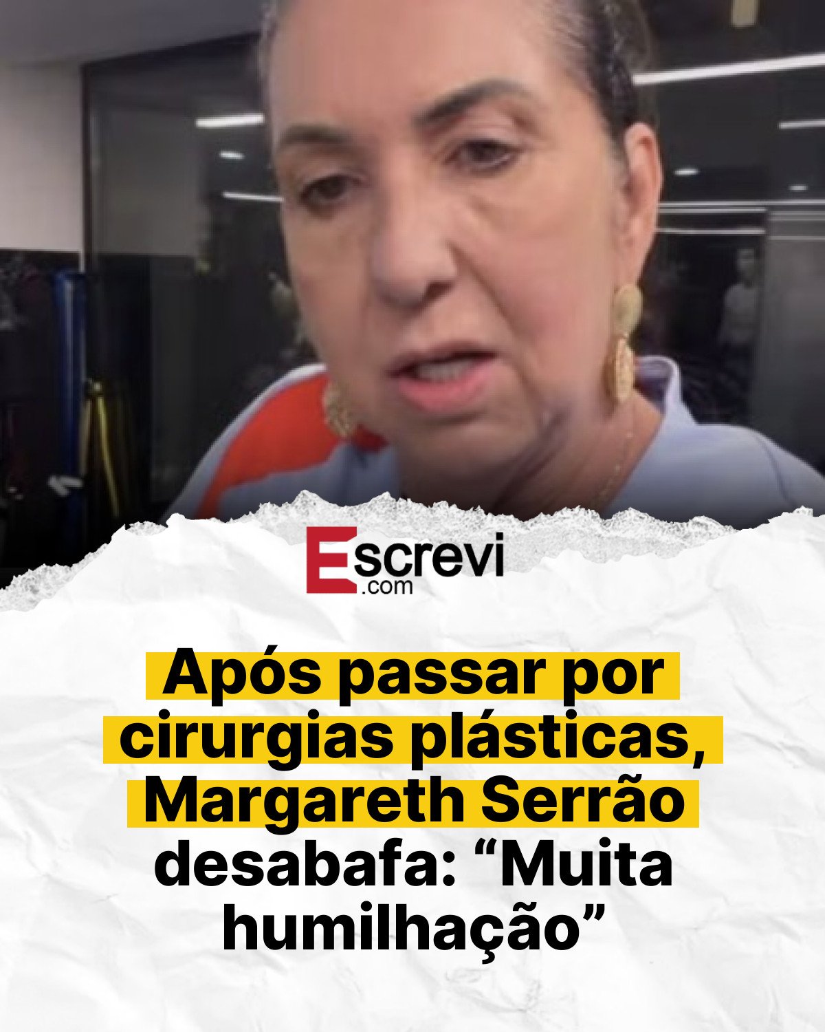 Após passar por cirurgias plásticas, Margareth Serrão desabafa: “Muita humilhação” card branco