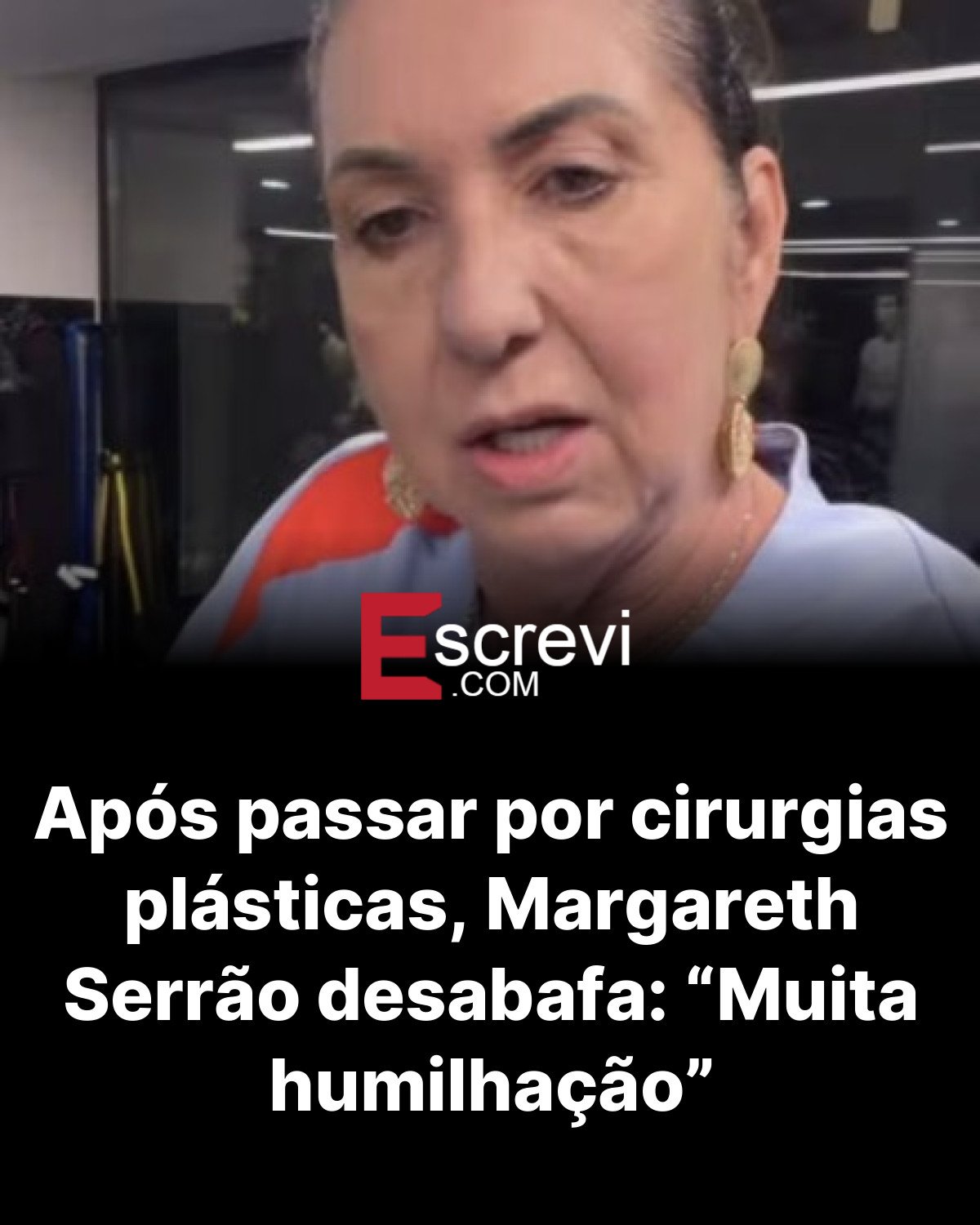 Após passar por cirurgias plásticas, Margareth Serrão desabafa: “Muita humilhação” card preto