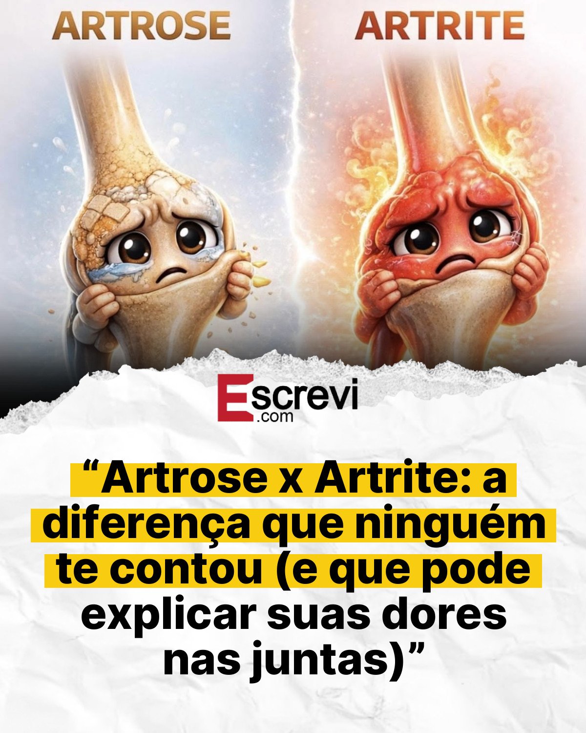 “Artrose x Artrite: a diferença que ninguém te contou (e que pode explicar suas dores nas juntas)” card branco