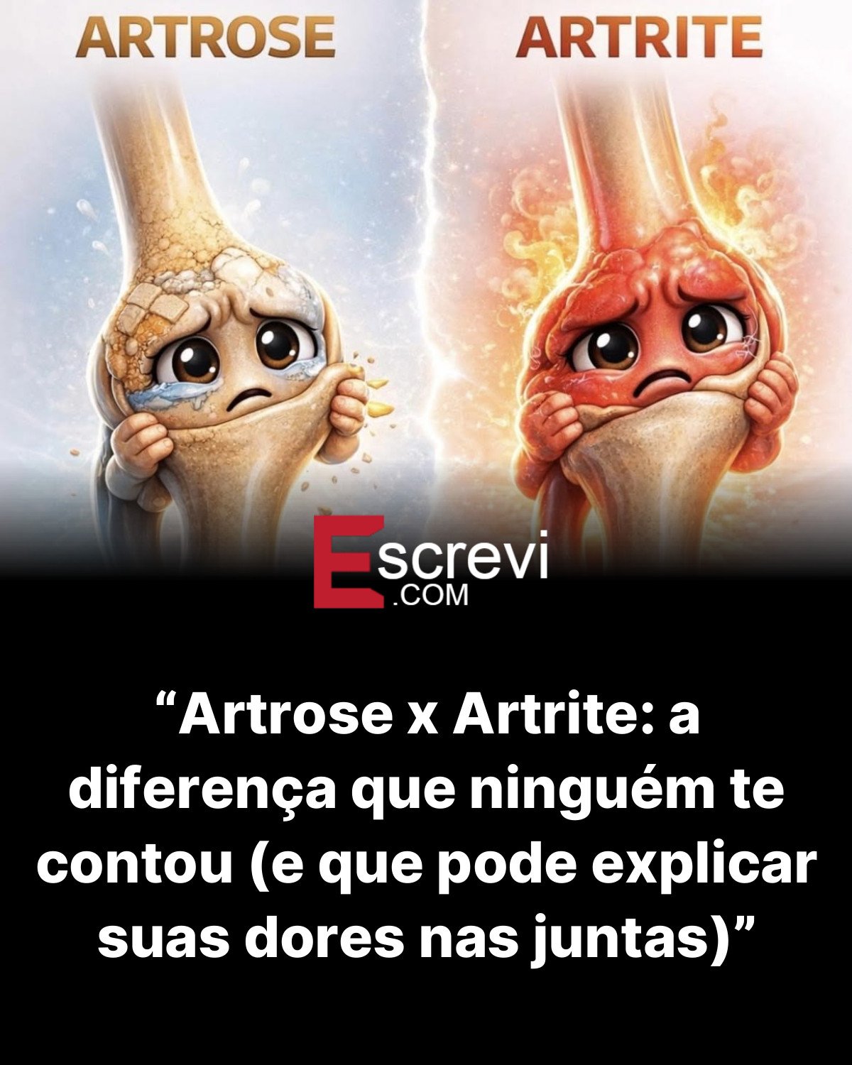 “Artrose x Artrite: a diferença que ninguém te contou (e que pode explicar suas dores nas juntas)” card preto