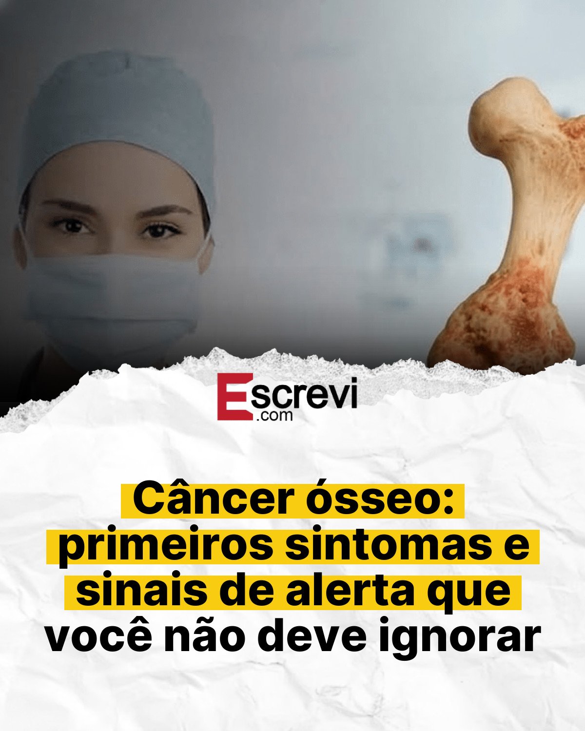 Câncer ósseo: primeiros sintomas e sinais de alerta que você não deve ignorar card branco