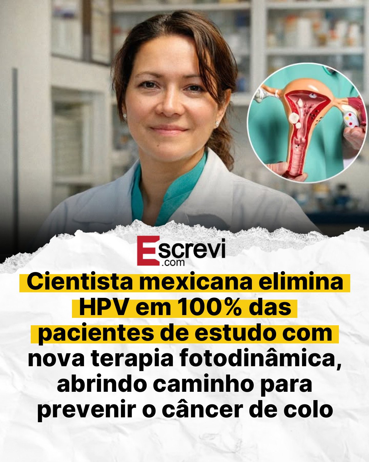 Cientista mexicana elimina HPV em 100% das pacientes de estudo com nova terapia fotodinâmica, abrindo caminho para prevenir o câncer de colo do útero card branco