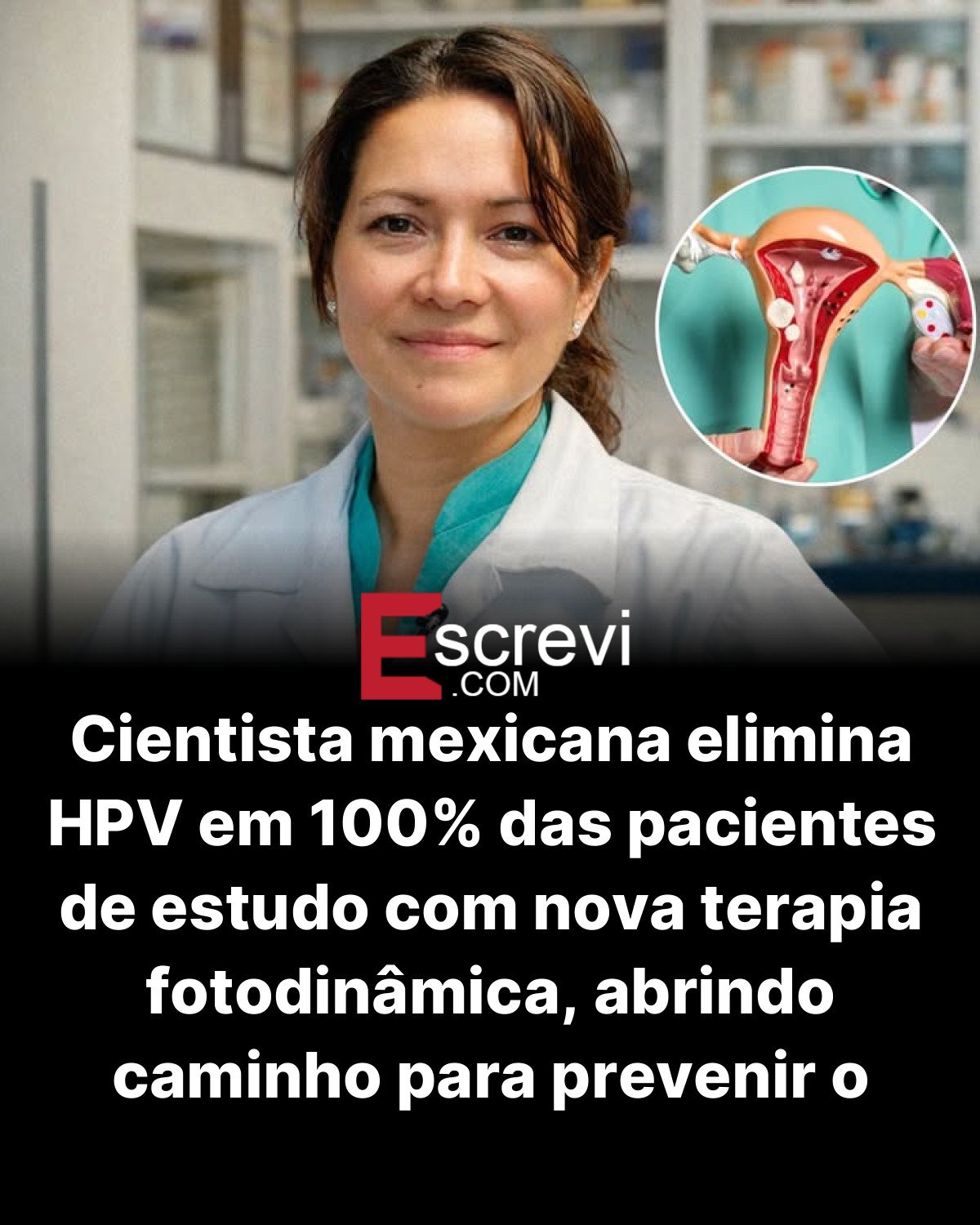 Cientista mexicana elimina HPV em 100% das pacientes de estudo com nova terapia fotodinâmica, abrindo caminho para prevenir o câncer de colo do útero card preto