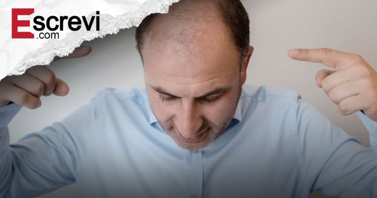 Cientistas descobrem possível “cura” para calvície que faz cabelo crescer em apenas 20 dias imagem principal