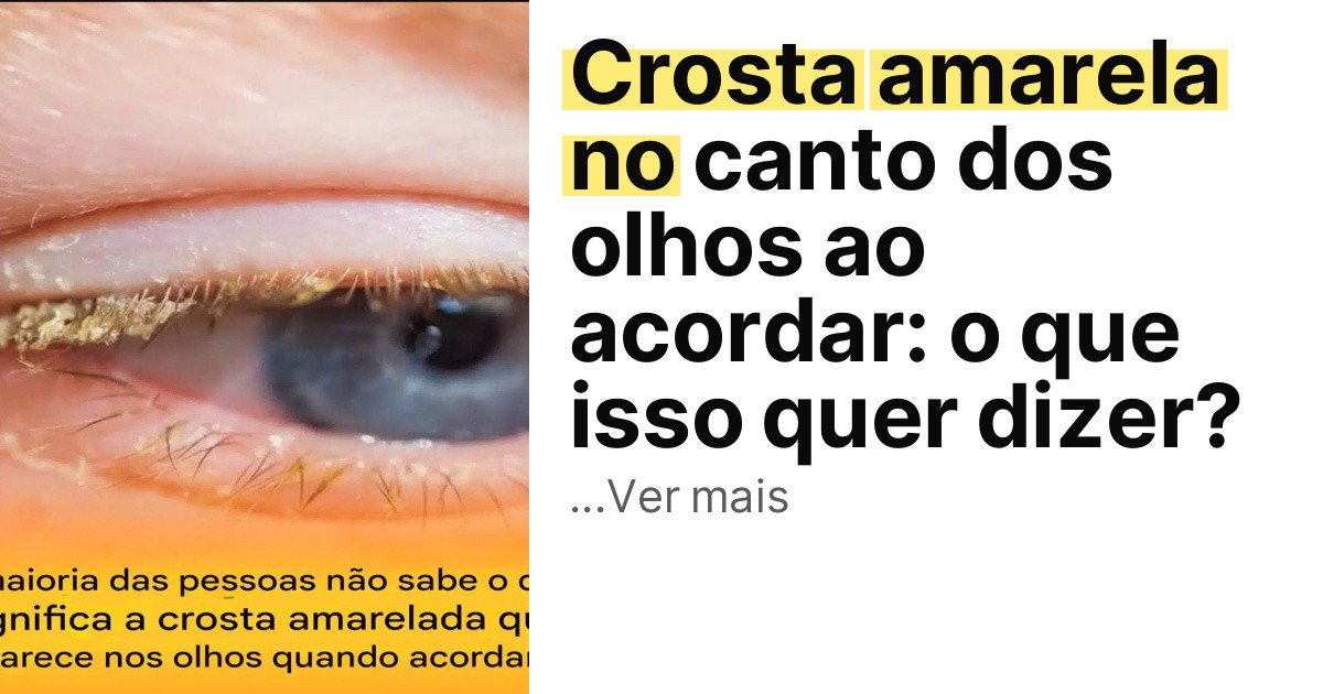 Crosta amarela no canto dos olhos ao acordar: o que isso quer dizer? imagem principal
