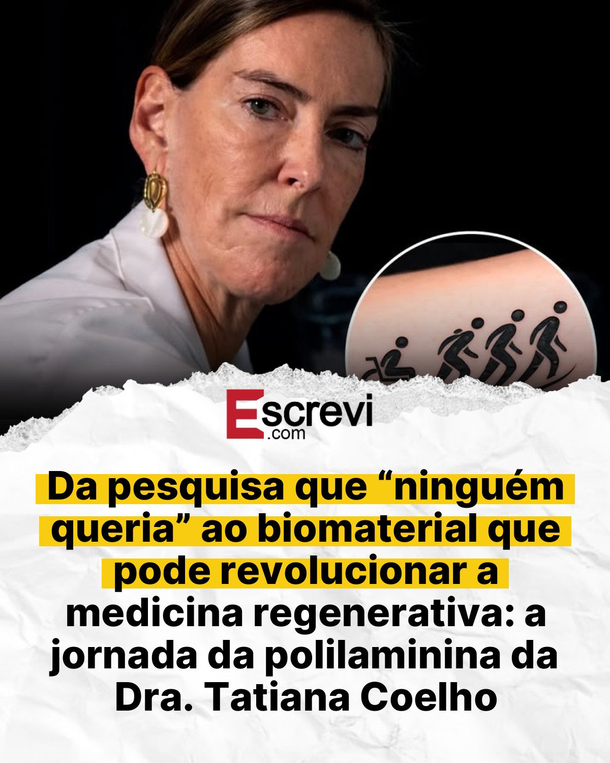 Da pesquisa que “ninguém queria” ao biomaterial que pode revolucionar a medicina regenerativa: a jornada da polilaminina da Dra. Tatiana Coelho card branco