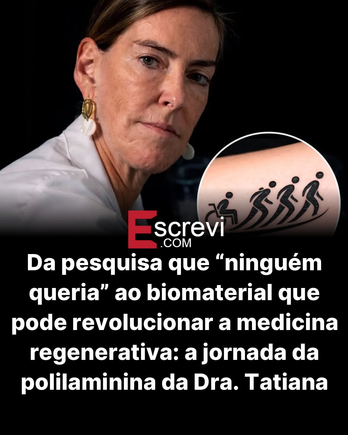 Da pesquisa que “ninguém queria” ao biomaterial que pode revolucionar a medicina regenerativa: a jornada da polilaminina da Dra. Tatiana Coelho card preto