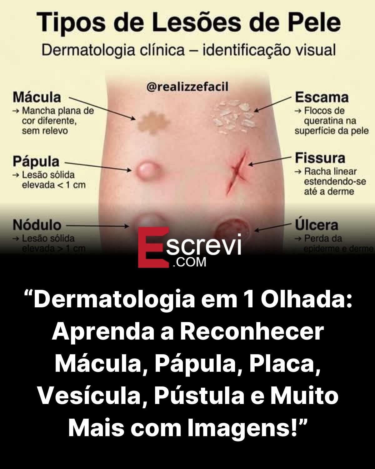 “Dermatologia em 1 Olhada: Aprenda a Reconhecer Mácula, Pápula, Placa, Vesícula, Pústula e Muito Mais com Imagens!” card preto
